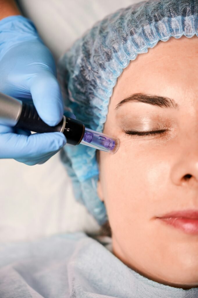 Female client having fractional mesotherapy in beauty salon.